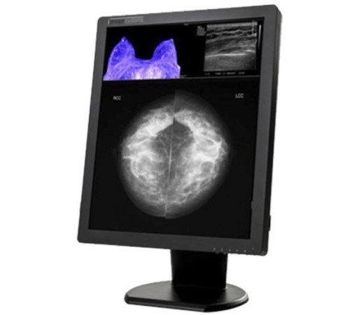 Double Black Imaging Image Systems 5MP Color Diagnostic Display (C5MPN)